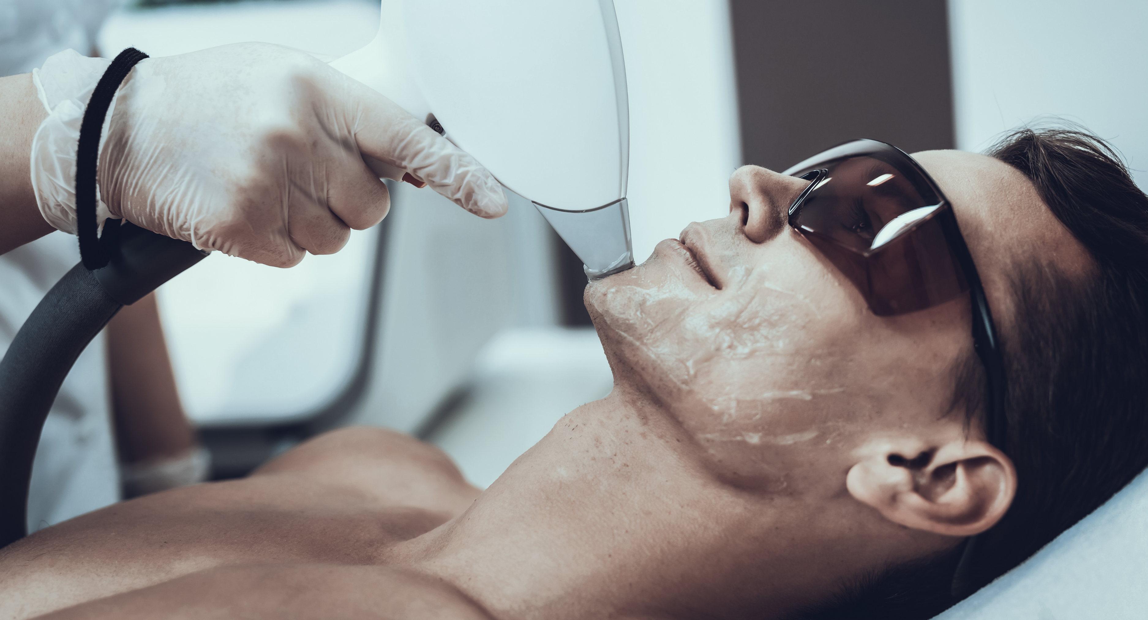 Depilación Láser Masculina — Rostro y Cuello